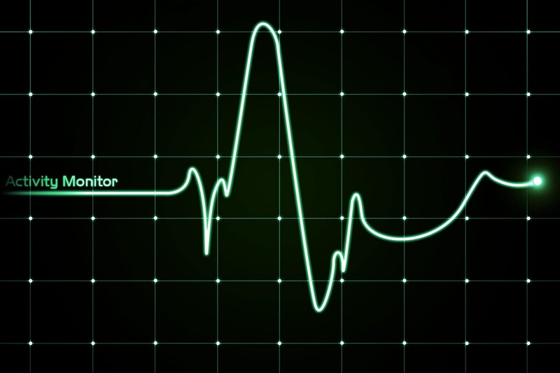 Activity Monitor Graph — Black