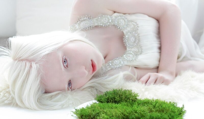 Albino Woman Lying Down