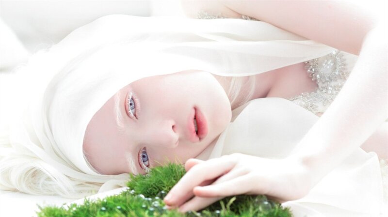 Albino Woman Lying