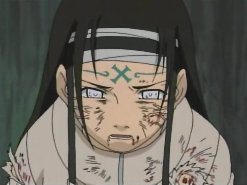 Anime Character with Injuries — Black