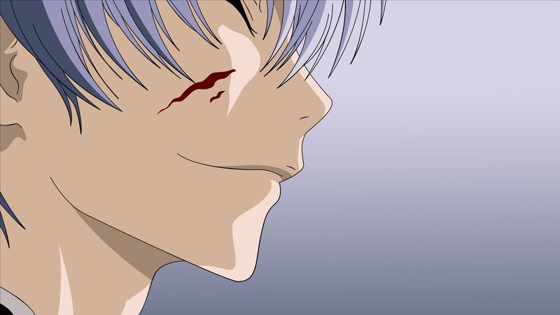 Anime Character with Injury — Gray