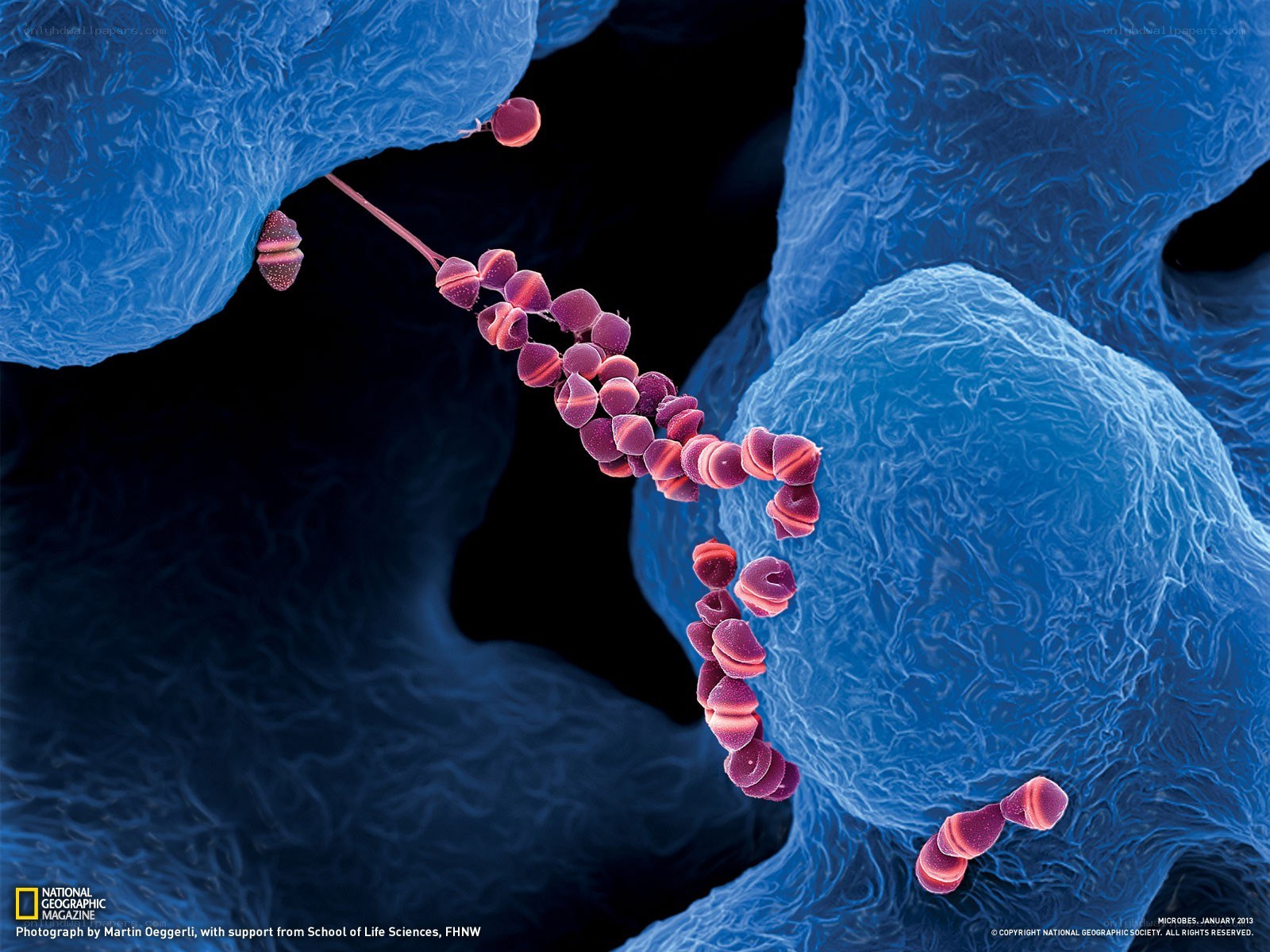 Bacteria on human cells