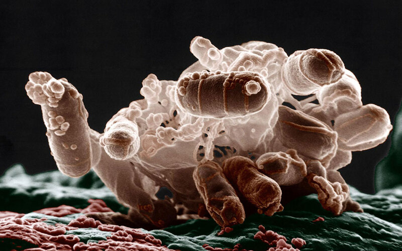 Bacteria on human tissue