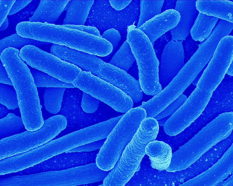 bacterial cells under microscope