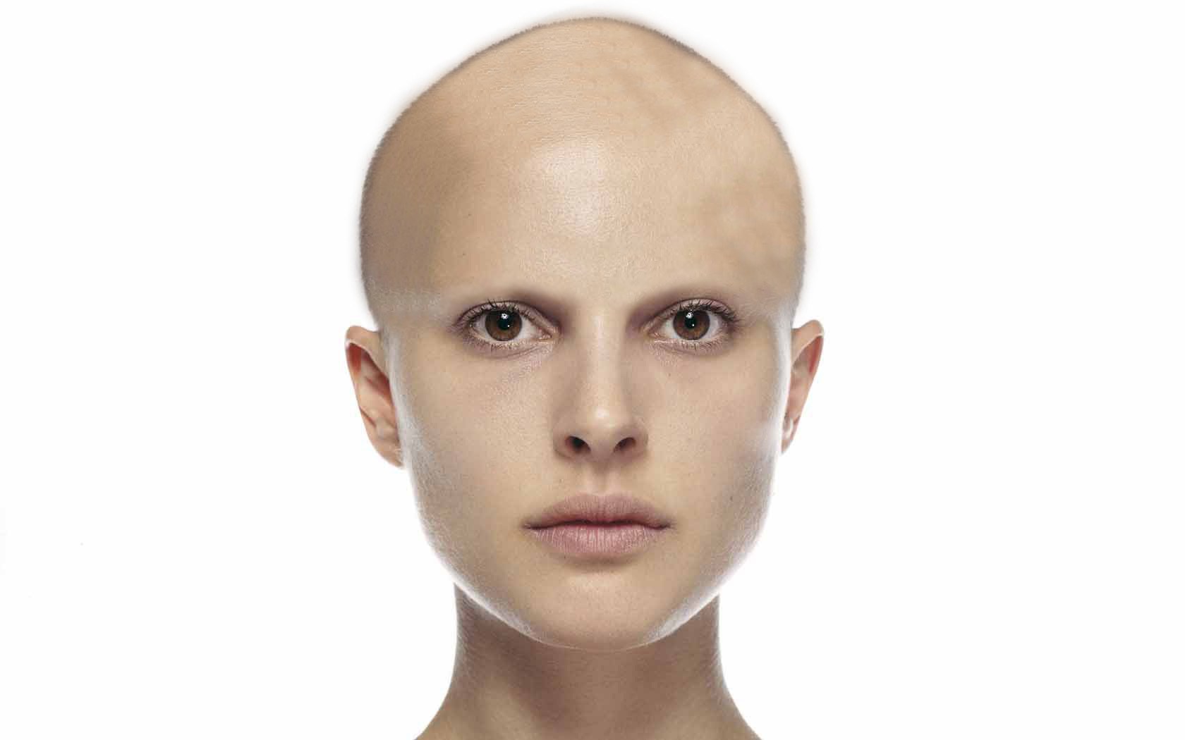 bald woman portrait
