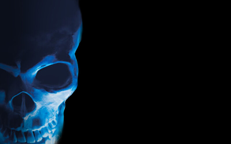 blue skull x-ray image