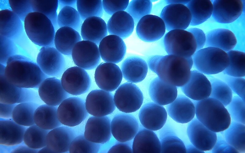 Blue Spherical Cells