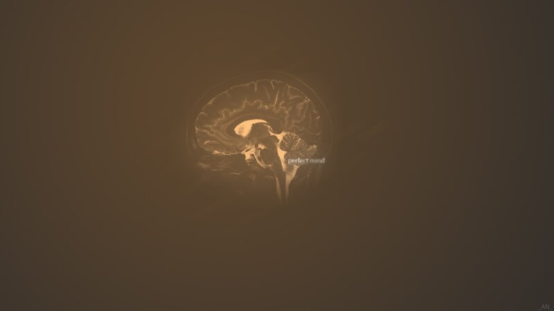Brain Scan Image