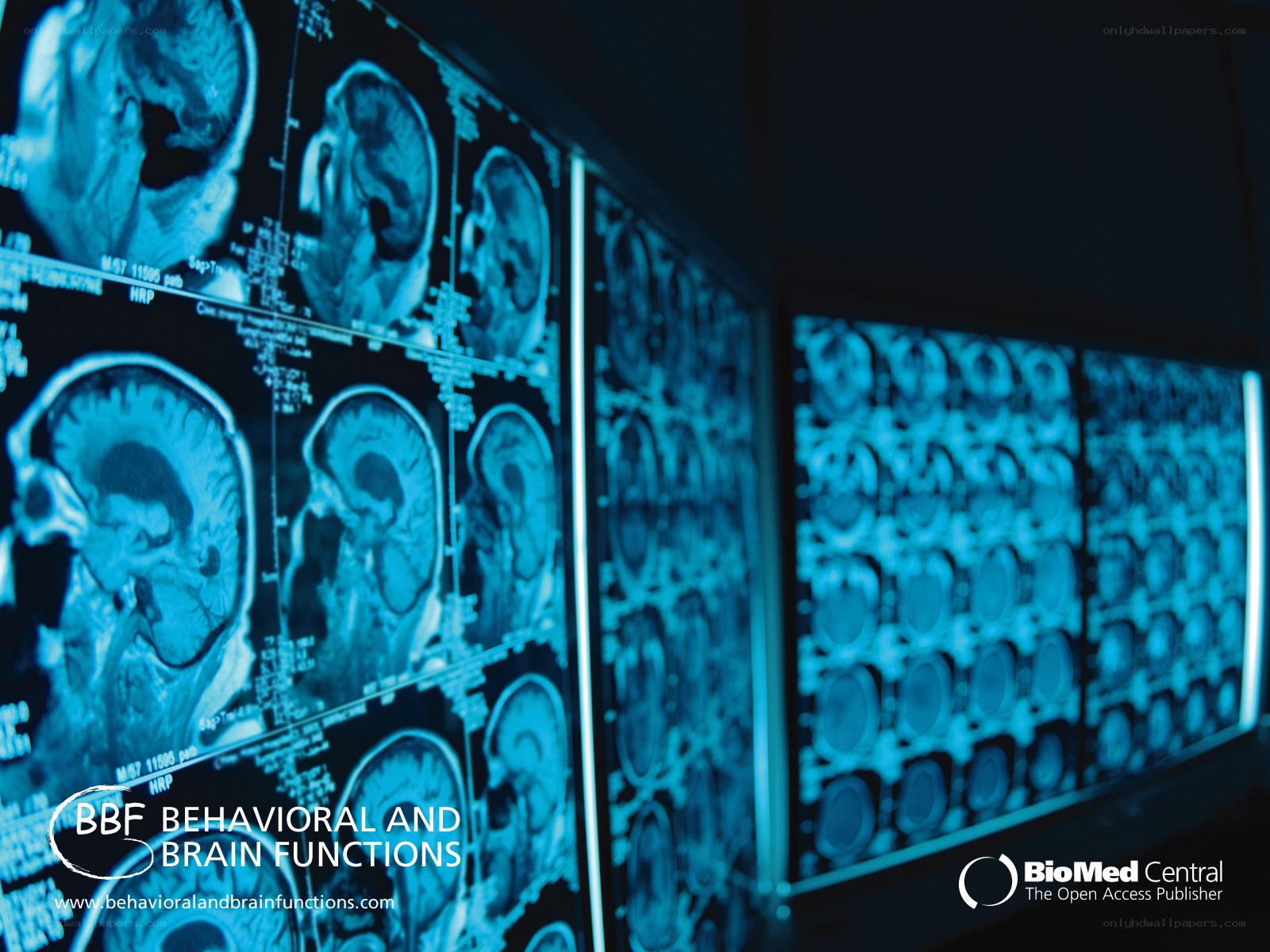 brain scans in a medical setting