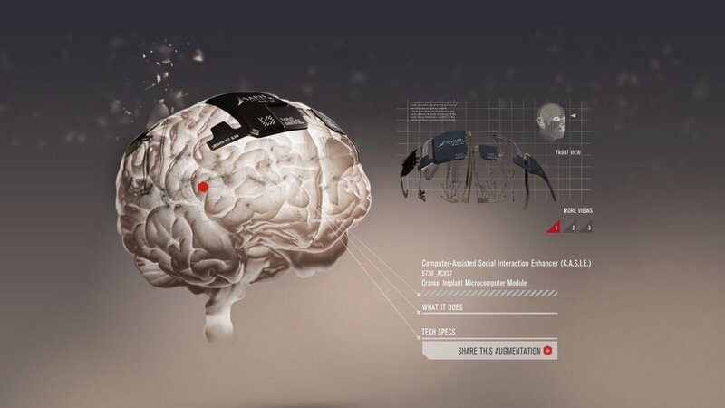 Brain with Implant
