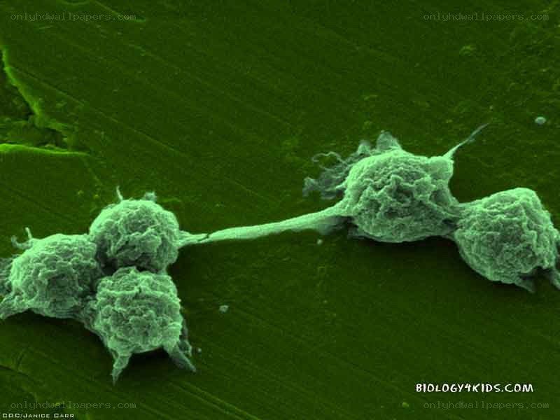 Cancer cells under microscope