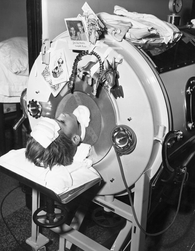 Child in iron lung machine
