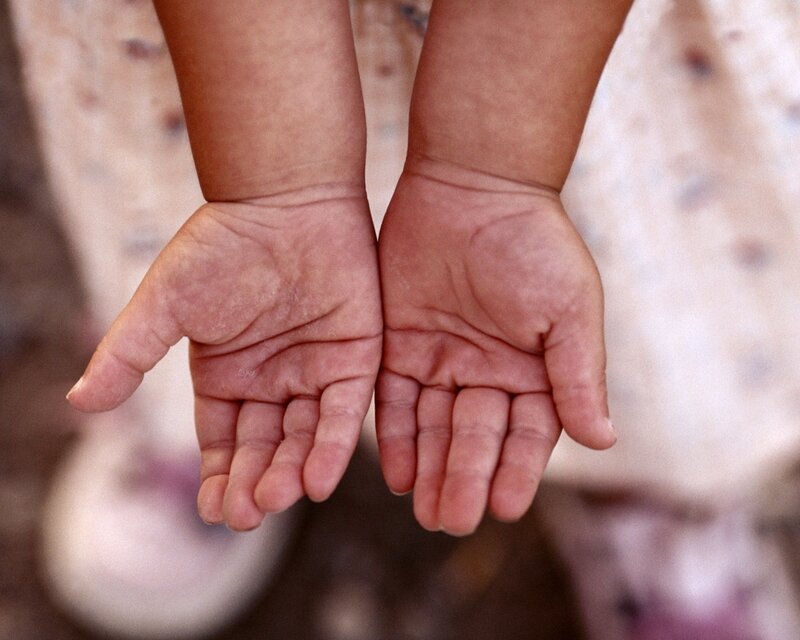 child's hands open palms