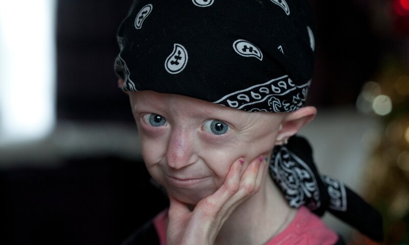 child with bandana and blue eyes