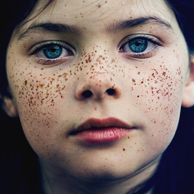 child with freckles and blue eyes