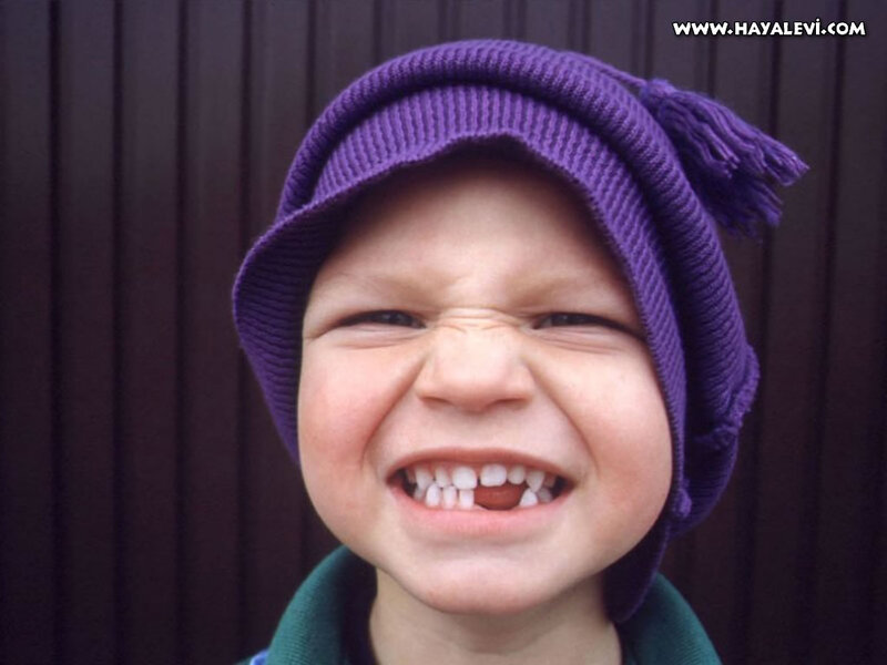 Child with Missing Tooth — Purple