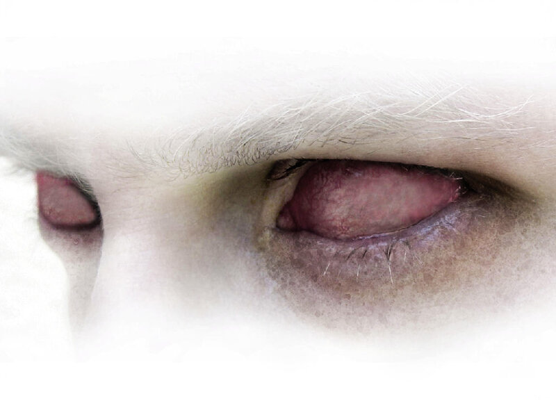 close-up of a bloodshot eye