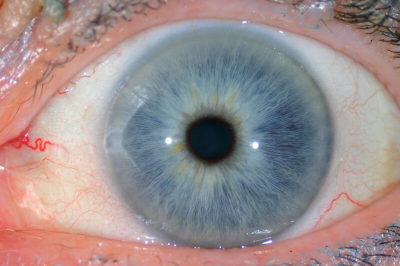 close-up of a blue eye