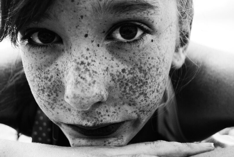 Close-up of a freckled face