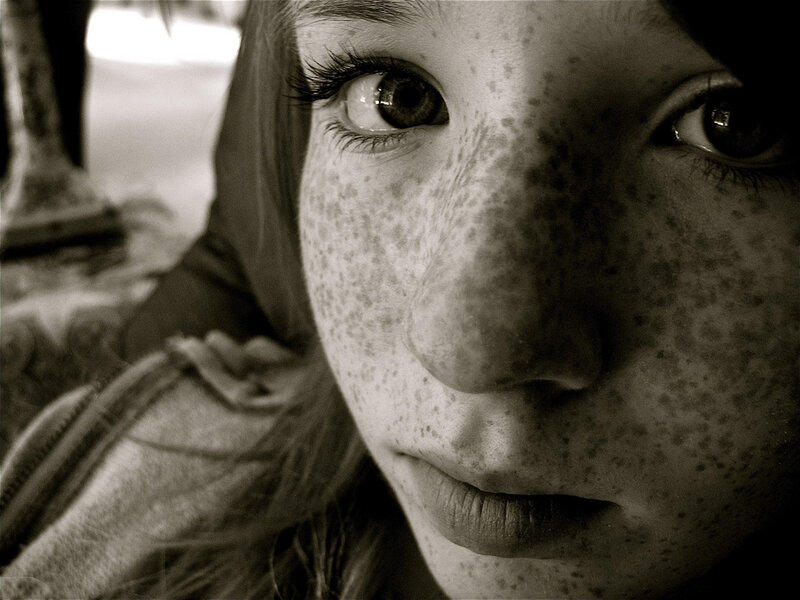close-up of a freckled face