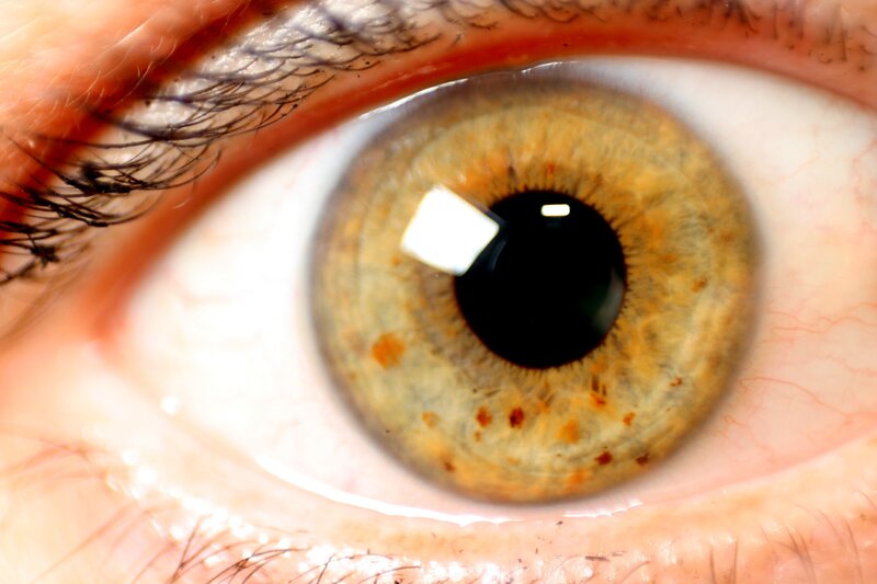 Close-up of a human eye