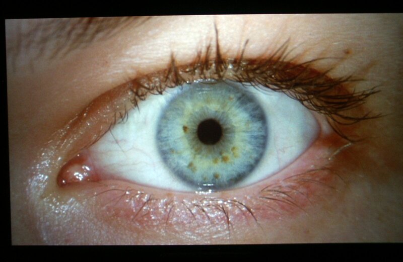 close-up of a human eye