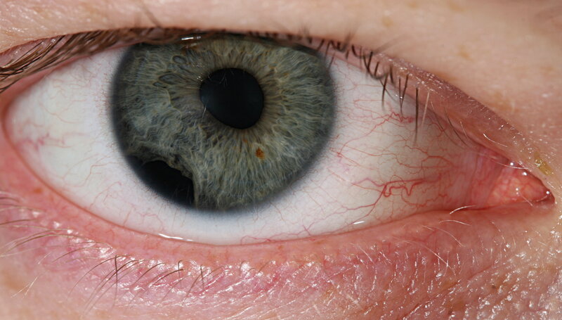 close-up of a human eye