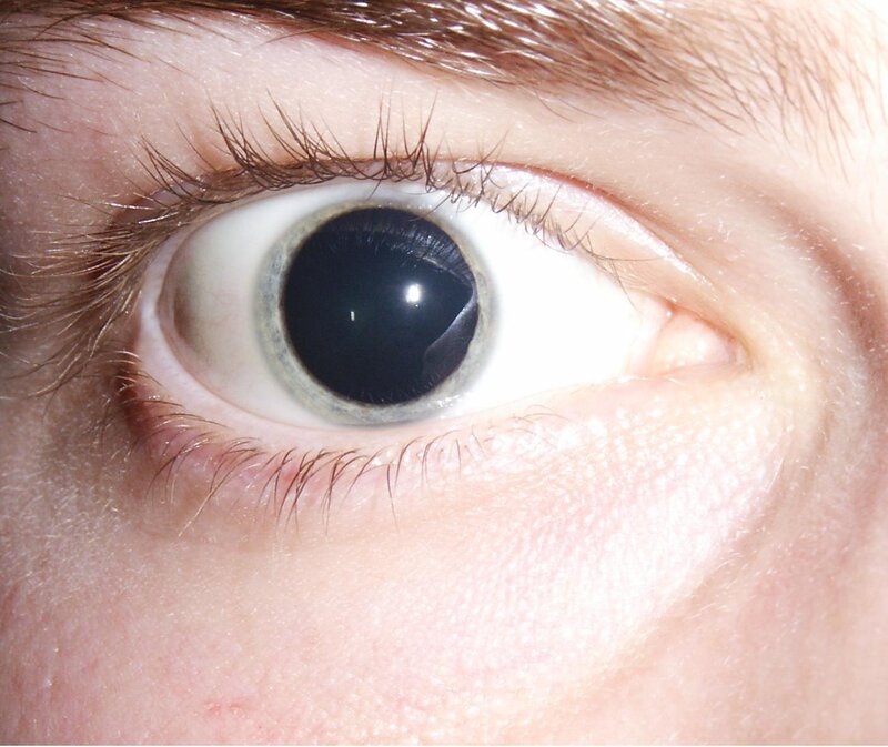 close-up of a human eye