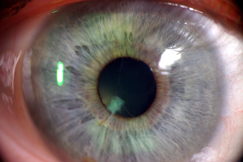 close-up of a human eye