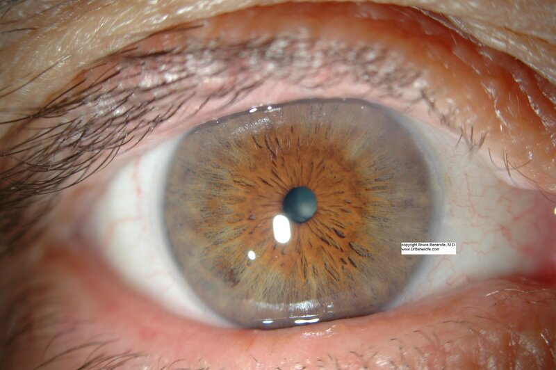 close-up of a human eye