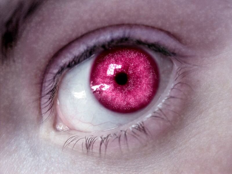 Close-up of a Red Eye — Dramatic, Photograph