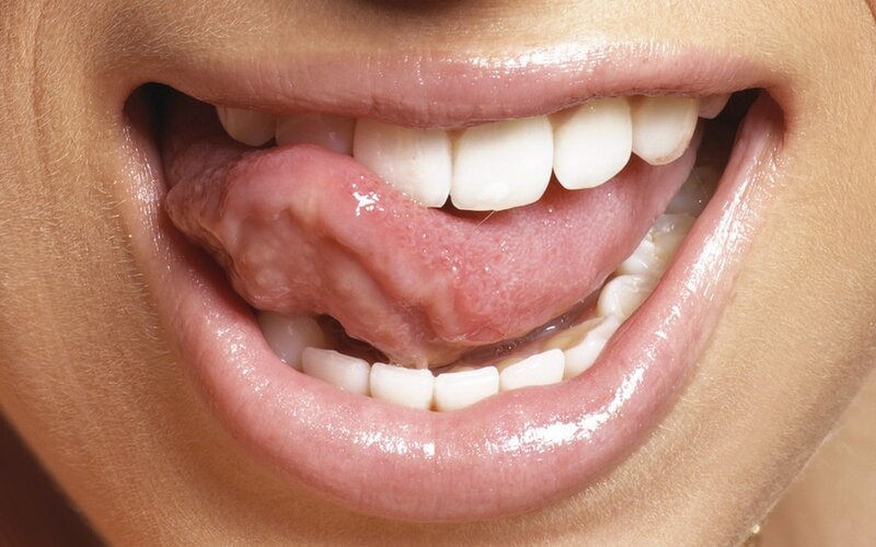 close-up of a smiling mouth