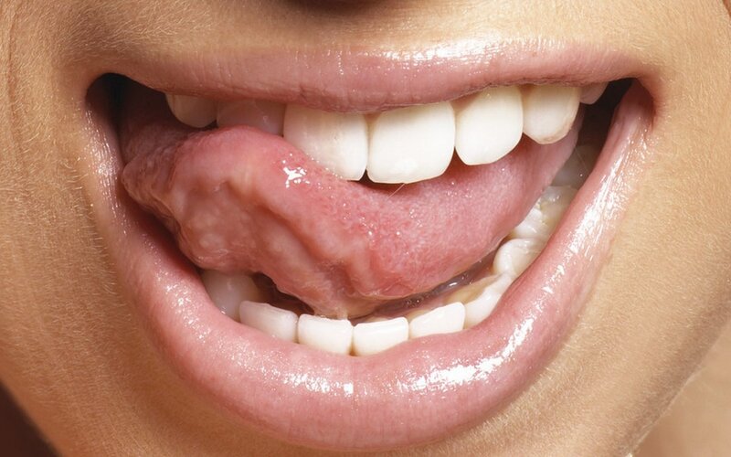 close-up of a smiling mouth