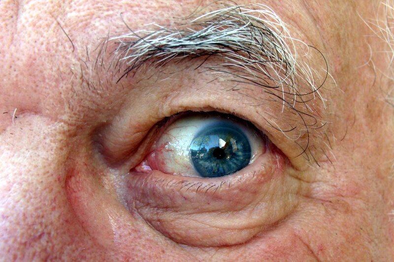 close-up of an elderly person's eye