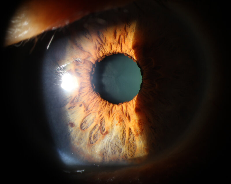 close-up of an eye