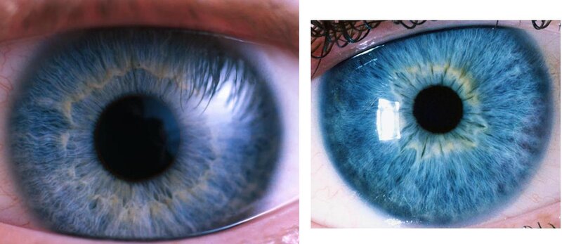 close-up of blue eyes