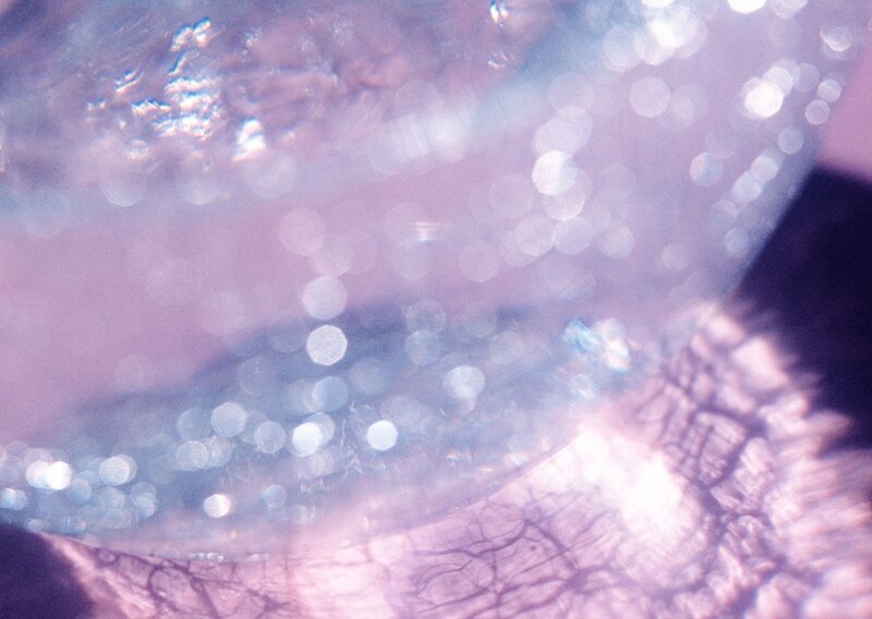 Close-up of eye with lens