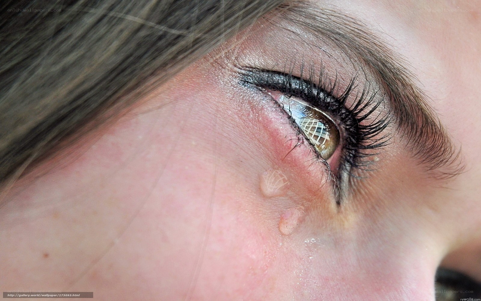 close-up of eye with skin growth