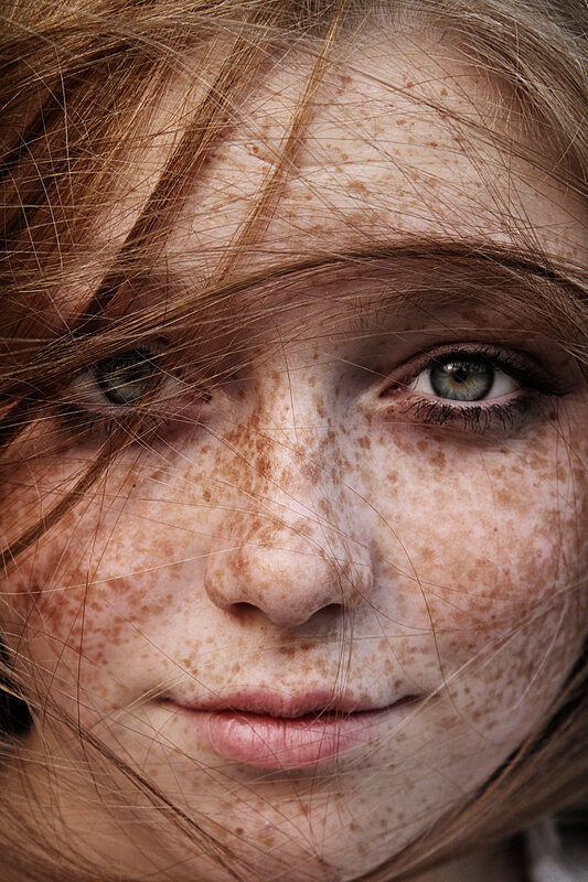 close-up of freckled face