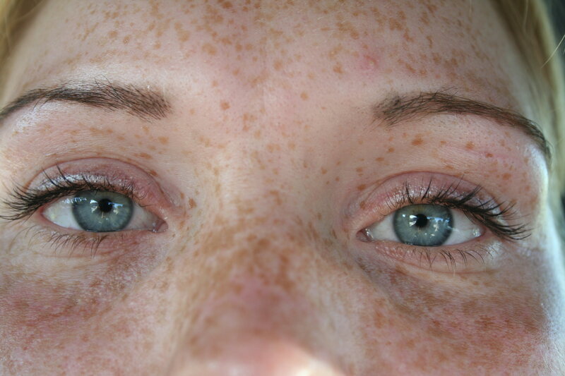 close-up of freckled face