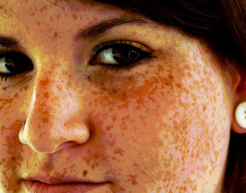 close-up of freckled face