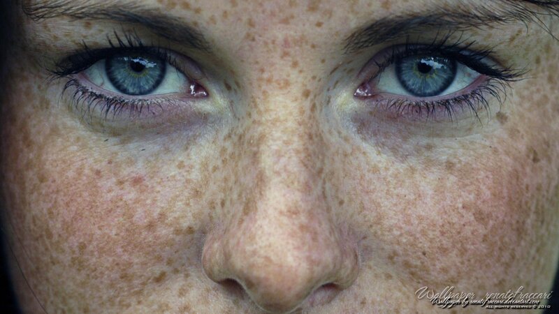 close-up of freckled face