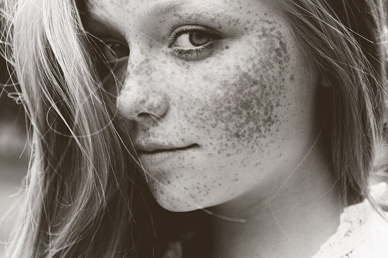 close-up of freckled face