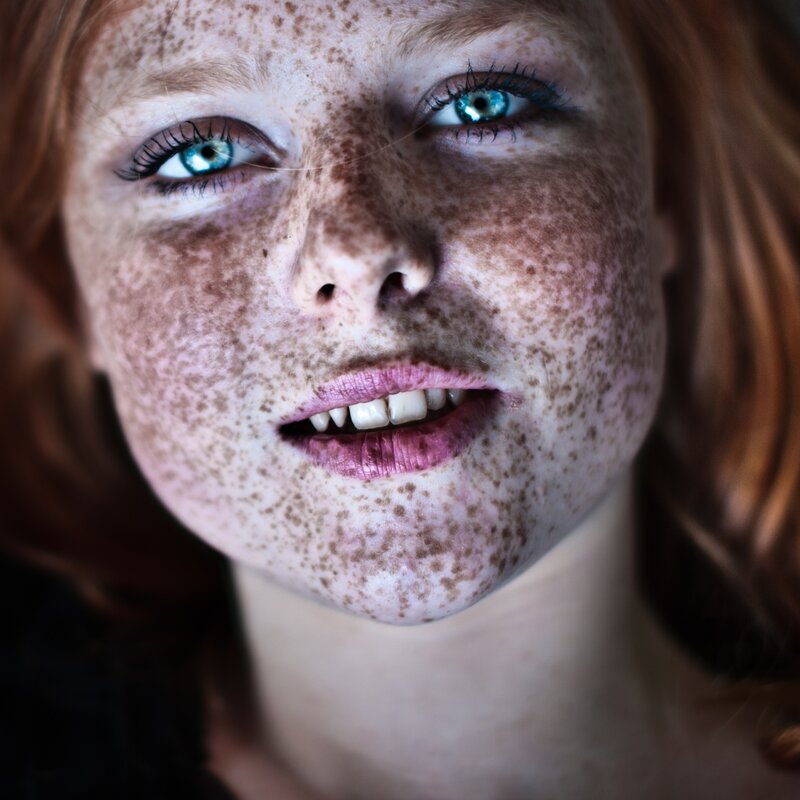 close-up of freckled face