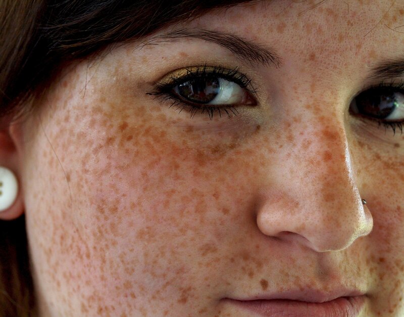 close-up of freckled face