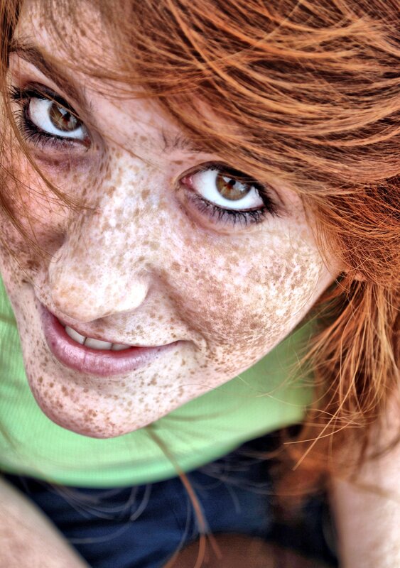 close-up of freckled face
