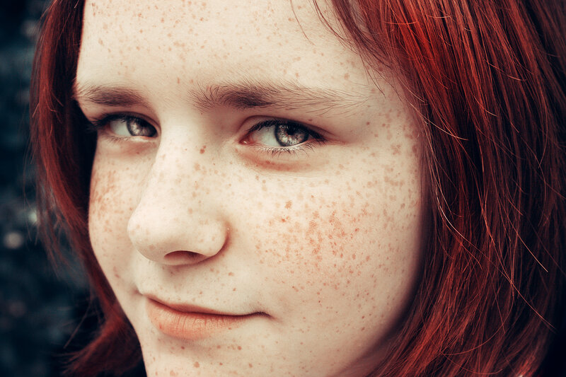 close-up of freckled face