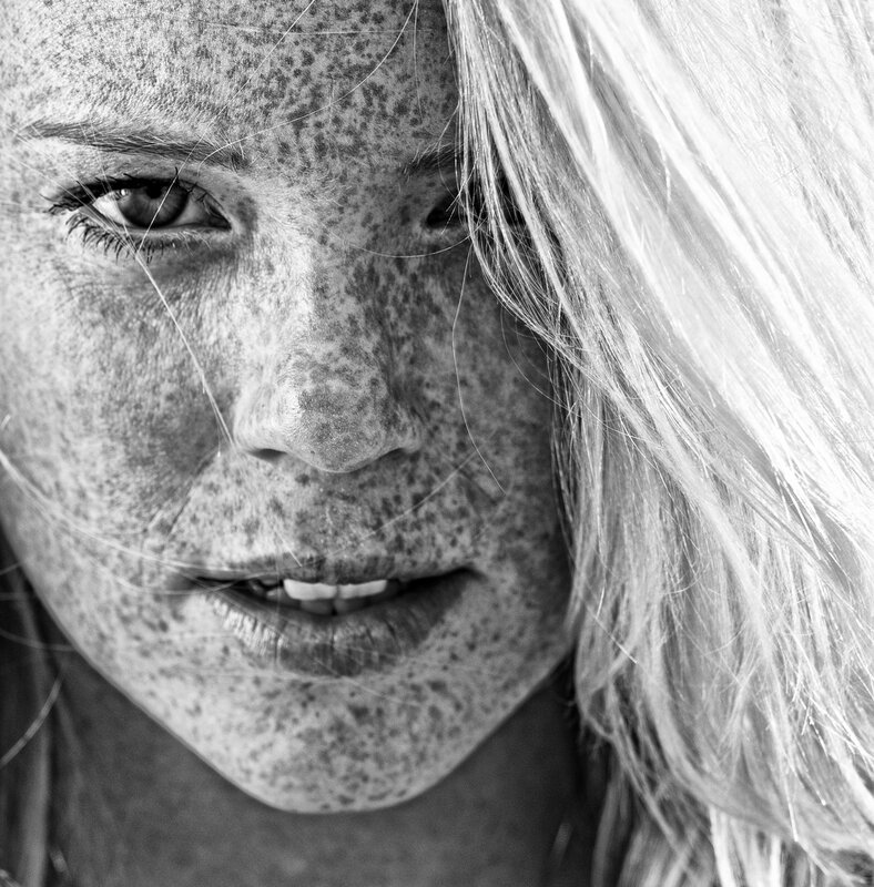 close-up of freckled face