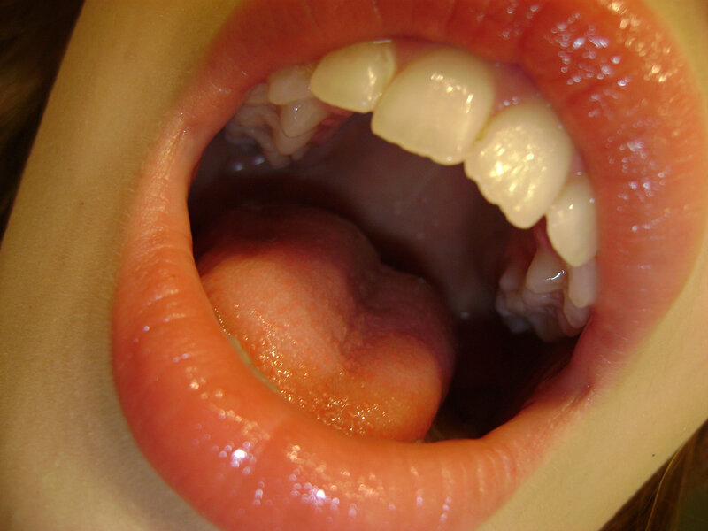 close-up of open mouth