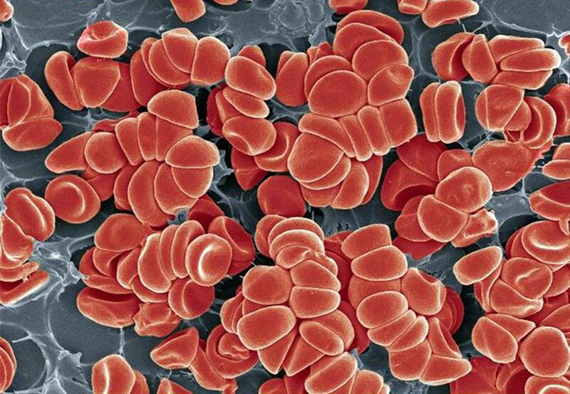clustered red blood cells